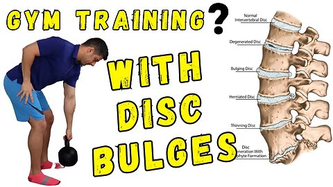How to Train in the gym with lumbar disc bulges (phase one)