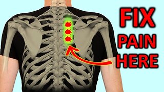 "RHOMBOID PAIN": HOW TO FIX SHOULDER BLADE PAIN QUICKLY.