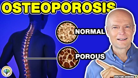 Prevent Osteoporosis Diet Naturally - Dr Ekberg