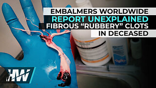 EMBALMERS WORLDWIDE REPORT UNEXPLAINED FIBROUS “RUBBERY” CLOTS IN DECEASED | The HighWire