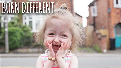 The Only Girl In The World With 'Benjamin Button' Disease | BORN DIFFERENT