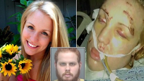 Stabbed 32 Times By Ex-Boyfriend, She Should Have Died. EMT Who Found Her Dying Says These 5 Words