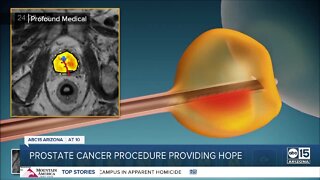 A new treatment option for men battling prostate cancer