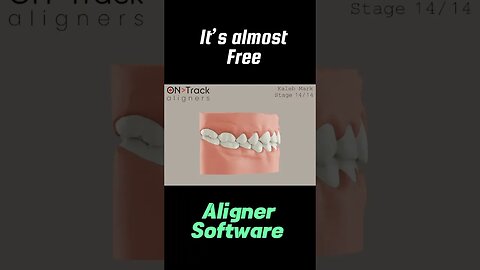 FREE Aligner Software?