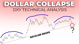 WILL THE DOLLAR COLLAPSE? | DXY Technical Analysis