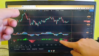 BITCOIN: 🚨 TODAY!!! Bitcoin Price Prediction & BTC Update Today and BTC Analysis Today