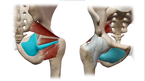 Animated human body anatomy of hip labral_tear part 1 hip