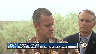 Border Patrol agent infected with flesh-eating bacteria