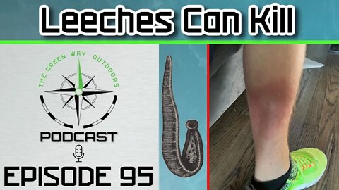 Episode 95 - Leeches Can Kill - The Green Way Outdoors Podcast