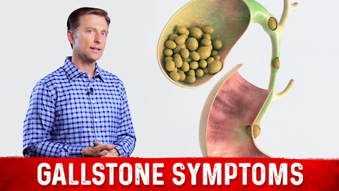 Gallstone Symptoms and Causes Explained – Dr.Berg on Gallbladder Stone Removal