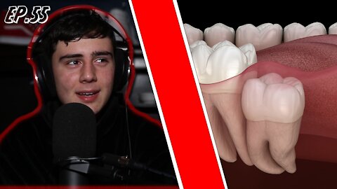 My Wisdom Teeth Removal (Demetri's Ted Talk Ep. 55)