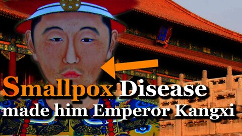 How Emperor Kangxi Controlled Smallpox Disease in China?