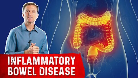 The Most Common Nutrient Deficiency in IBD (Inflammatory Bowel Disease)