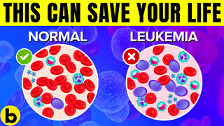 This Study On Gene Mutations And Leukemia Can Save Your Life