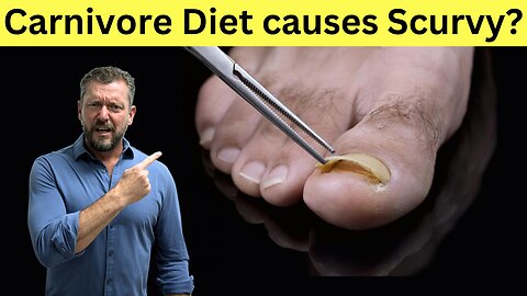 Will the Carnivore Diet cause Scurvy?