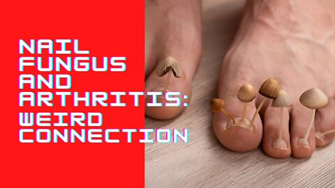 Nail Fungus and Arthritis: Weird Connection