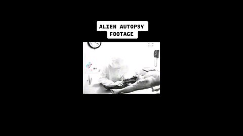 alien autopsy