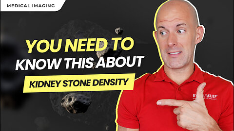 Kidney Stone Density & Why It's Important [The Hounsfield Unit]