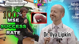 100% MSE Success Rate (MUST WATCH) - Dr. Ilya Lipkin, DDS | JawCast #29