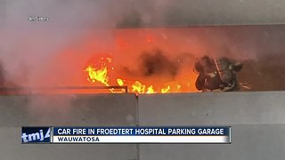 Froedtert Hospital parking garage fire under investigation