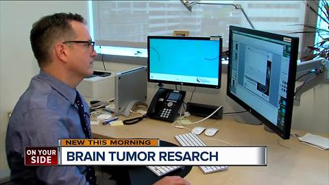 Cincinnati doctor trying new imaging technique for children with brain tumors