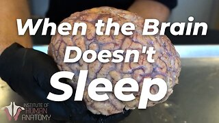 Why Sleep Is Important