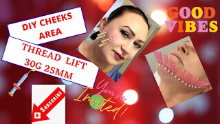 PDO/ PCL MONO THREADS LIFT AT HOME 30G, 25MM, VLOG#2 😍 #pdothreads #threadlift #diythreadlift