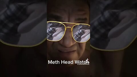 Yikes. Meth Head watch