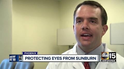 Valley doctor says you can get sunburn on your eyes