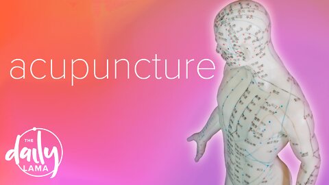 Acupuncture