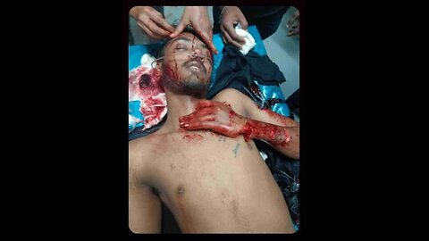 Bangladesh is now not safe for students...Government killed 500+ students in just 3 days...