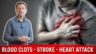 How to Prevent Blood Clots, Strokes & Heart Attacks? – Tips by Dr. Berg