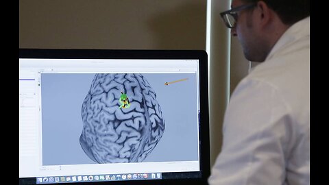 Ρώσοι επιστήμονες δημιουργούν μια νευροδιεπαφή που επιταχύνει τον εγκέφαλο