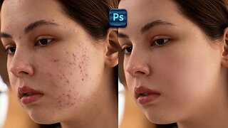 Skin Retouching in Photoshop | Tutorial For Beginners
