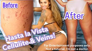 Cellulite, Varicose & Spider Vein Treatments & Supplements