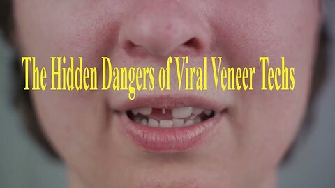 The Hidden Dangers of Viral Veneer Techs 😱