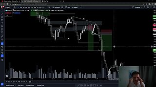 Getting OVER Losing Trades While Day Trading! (Managing Risk)