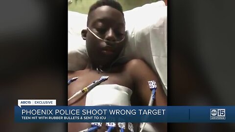 Valley teen in hospital after being misidentified by Phoenix police as a suspect in armed robbery