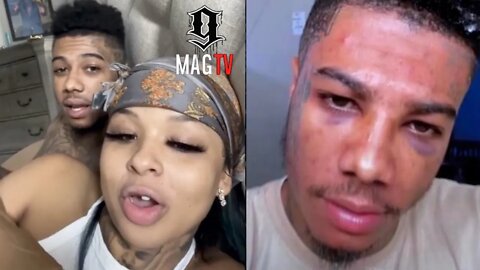 Blueface & Chrisean Rock Explain How His Face Got Blue! 🤕