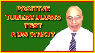 Tuberculosis (What The Positive Test Means)