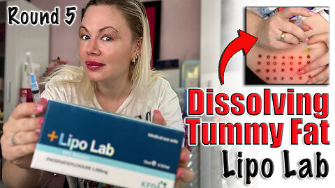 Dissolving Stomach Fat with Lipo Lab, Round 5 AceCosm | Code Jessica10 saves you Money