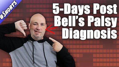 Bell's Palsy Recovery Story - 5-Days Post Diagnosis - Condition Update