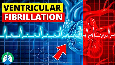 Ventricular Fibrillation (V-fib) | Medical Explainer Video