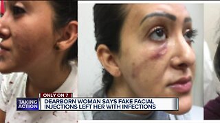 Woman says botched 'silicone' lip injections at metro Detroit salon led to oozing, infections