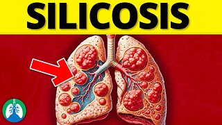 What is Silicosis? (EXPLAINED) 🫁