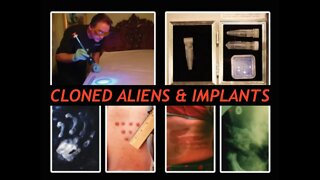 Mass Abduction, Cover Up, Former CIA - Alien Implants & Clones - The Evidence, Derrel Sims