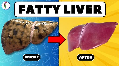 Clean fatty liver and loss weight in 10 days Part 1
