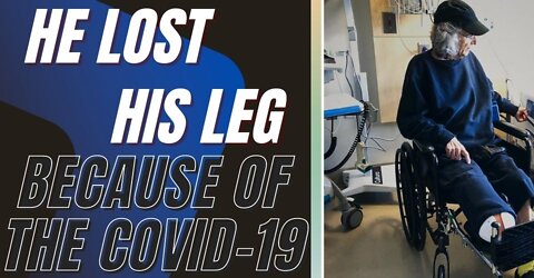 This Man Was Superfit When He Got COVID-19—And Then He Lost His Leg