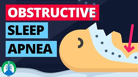 Obstructive Sleep Apnea (Medical Definition) | Quick Explainer Video