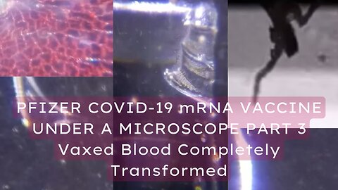 PFIZER COVID-19 mRNA VACCINE UNDER A MICROSCOPE PART 3 - Vaxed Blood Transformed